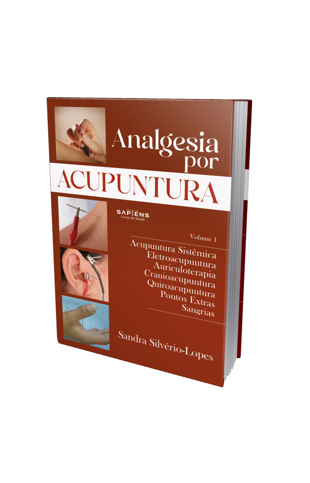 Analgesia por Acupuntura