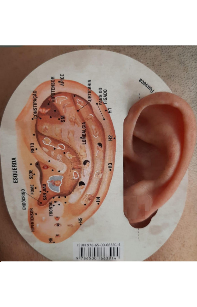 Gabarito de Auriculoterapia - 2