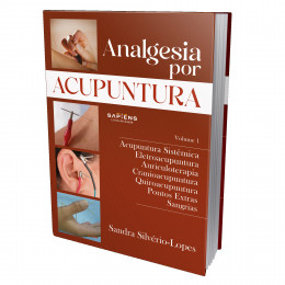 Analgesia por Acupuntura