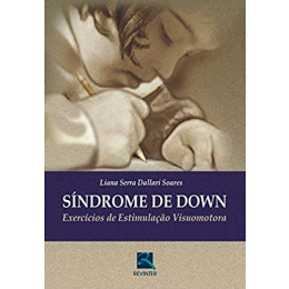 Síndrome de Down Exercícios de Estimulação Visuomotora 