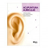 Acupuntura Auricular - 1